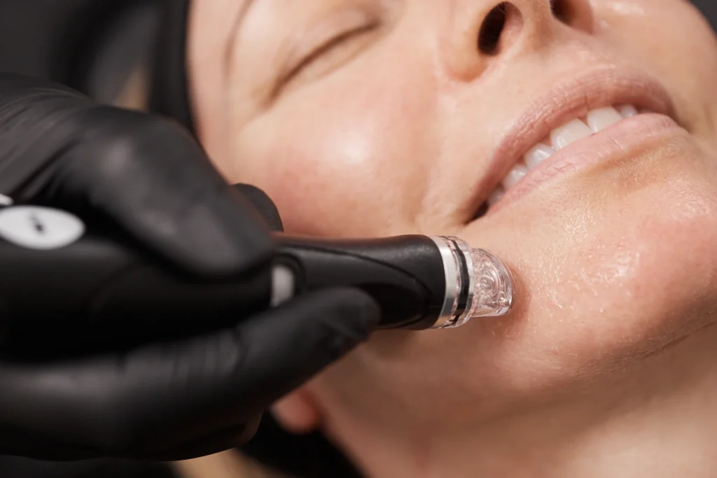 hydrafacial suitable skin types istanbul