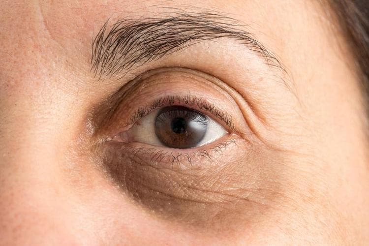 Carboxytherapy - Maslak 2 2EzZzmCx32HT9hlVn7Knrm0nmk5EgDHYhNvWkD eEuUERfOMOLR KMHhXMCLKw QrETlBh2Hque69sskDUGCQBbFMt6gwut2lXsFoB5jspdIuogyOFR9sZYBDYlRtObWV3PvUOWdkub5Q3vDLisq YO2s6 N7YfxCZlwbrIz yE dark circles treatment Istanbul